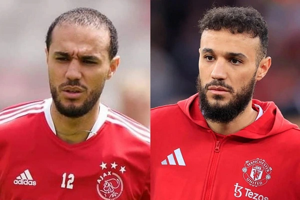 mazraoui before and after haartransplantatie