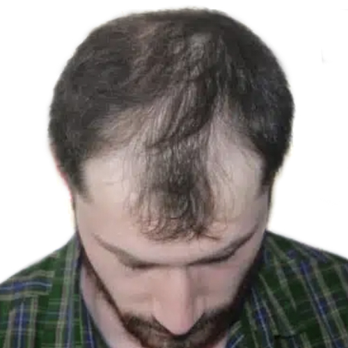 1 B