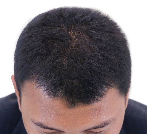Hairtp-after-3