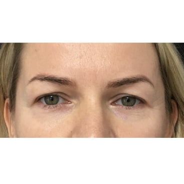 Transform Your Eyes