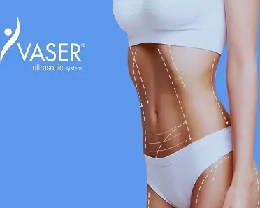 VASER Liposuction Liverpool