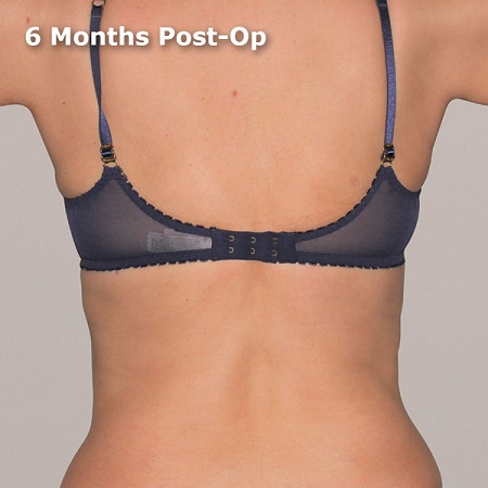 weight loss