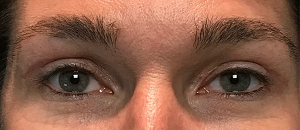 eyelids